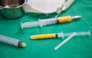 Adipose Stem Cell Therapies are Revolutionizing Plastic Surgery, and Demand is High