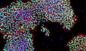 Breakthrough in scaling up life-changing stem cell production
