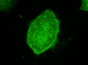 Purest Liver-like Cells to Date Generated from Induced Pluripotent Stem Cells (iPSCs)