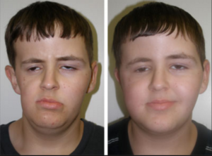 Adipose Stem Cell Therapies are Revolutionizing Plastic Surgery, and Demand is High