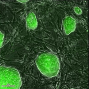 Stem cells may be used for healing damaged lungs